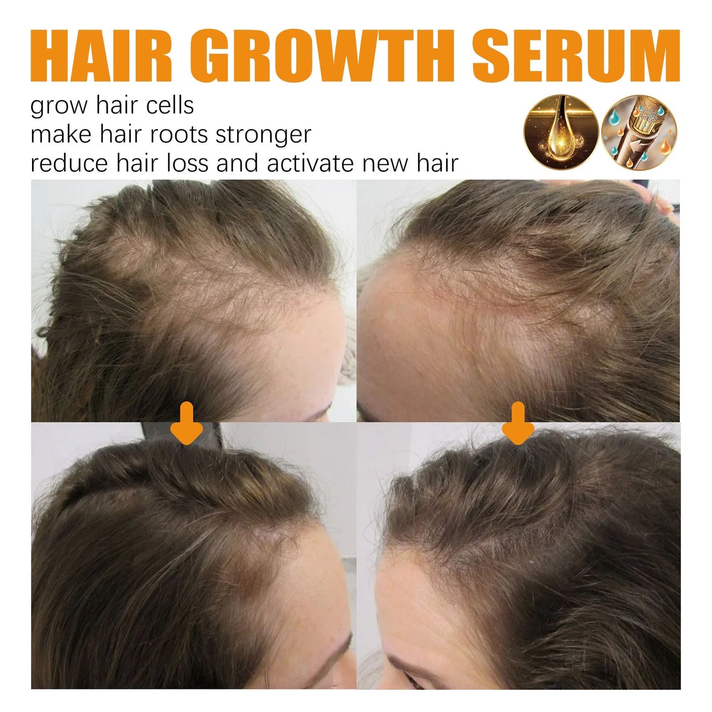 HairBoost Growth Essence